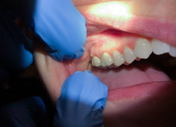 Best After-Hours Emergency Dentist in Coffeyville, KS