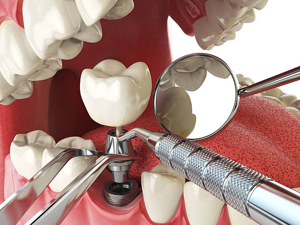 Best Emergency Dental Surgery in Coffeyville, KS